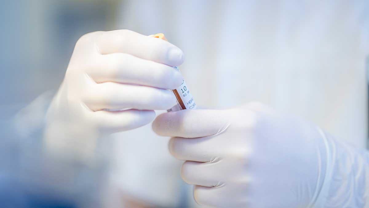 Svenska Werlabs har genomfört 60 000 antikroppstester i Sverige mot covid-19 och har kapacitet att testa upp till 100 000 personer per vecka. Bilden är tagen i samband med en annan provtagning av coronaviruset. (Foto: TT)