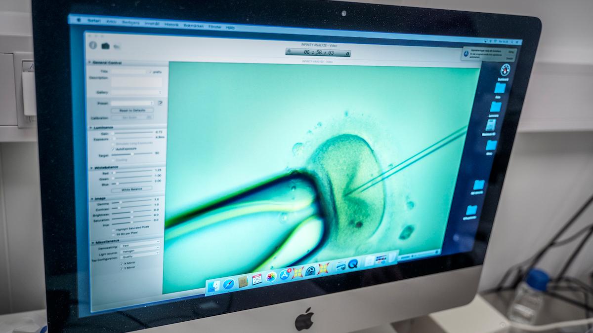Ett ägg befruktas. I USA kan nu föräldrar som genomgår IVF låta göra en genetisk testning för polygena sjukdomar innan inplantering av ett provrörsbefruktat embryo