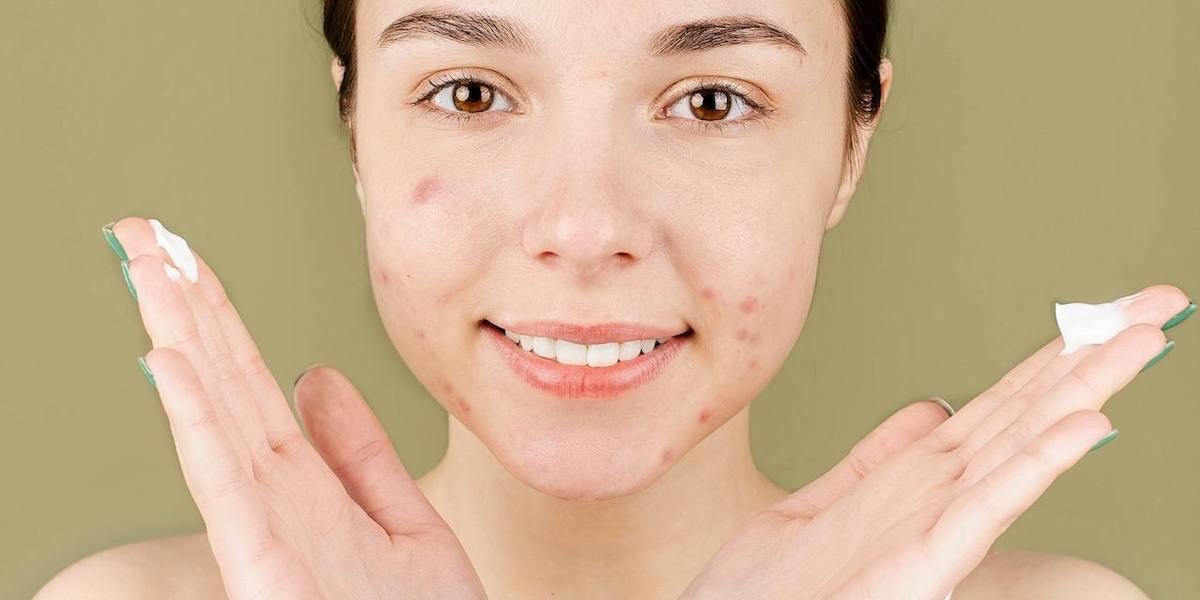 Enligt en ny rapport kan en farlig kemikalie bildas i vissa vanliga, receptfria, produkter för behandling av acne