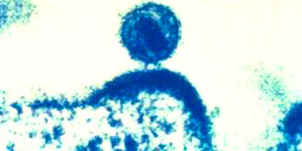 Ett enskilt humant immunbristvirus, hiv, när det kommer ur en infekterad mänsklig immuncell som hiv-viruset replikerats i