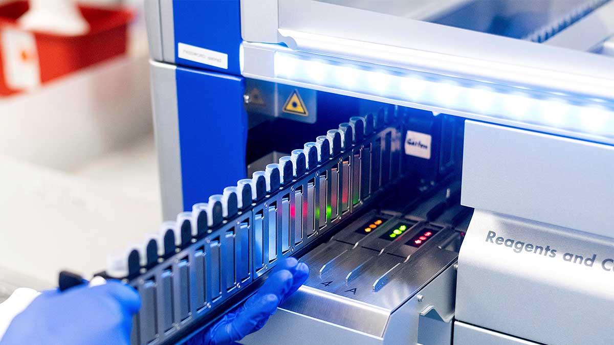 En studie visar lovande resultat gällande att Novanax vaccin mot covid-19 är effektivt mot den så kallade sydafrikanska varianten av viruset. (Foto: TT)
