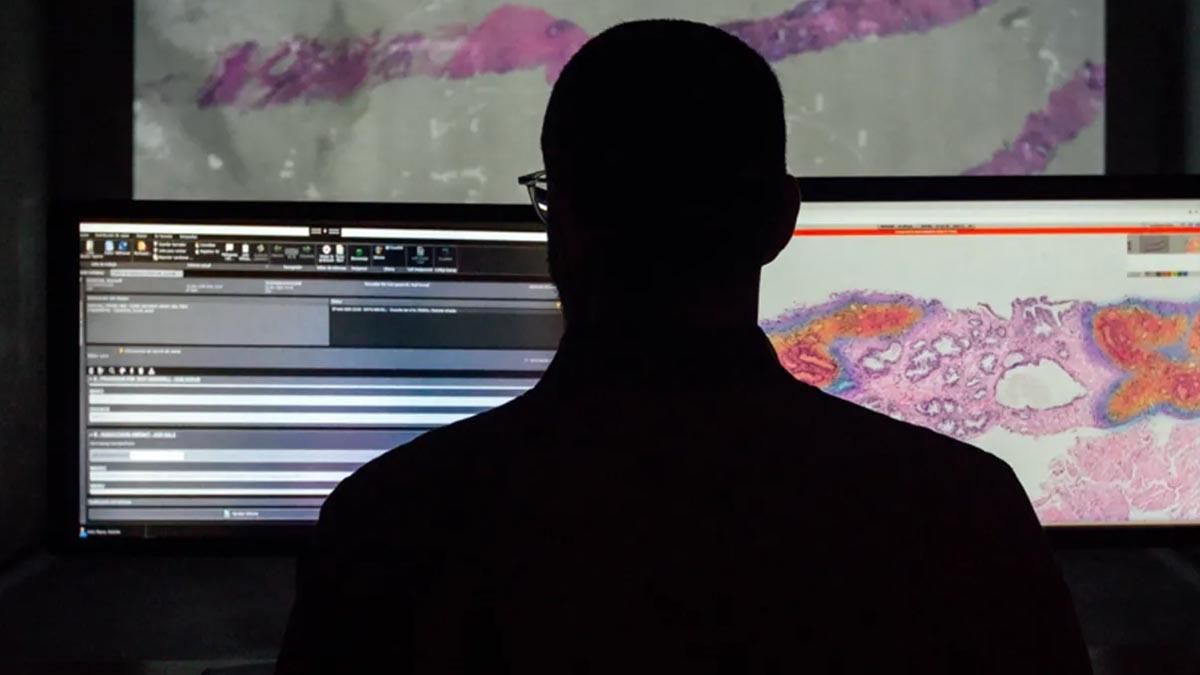 Diagnos av cancer med AI-teknik