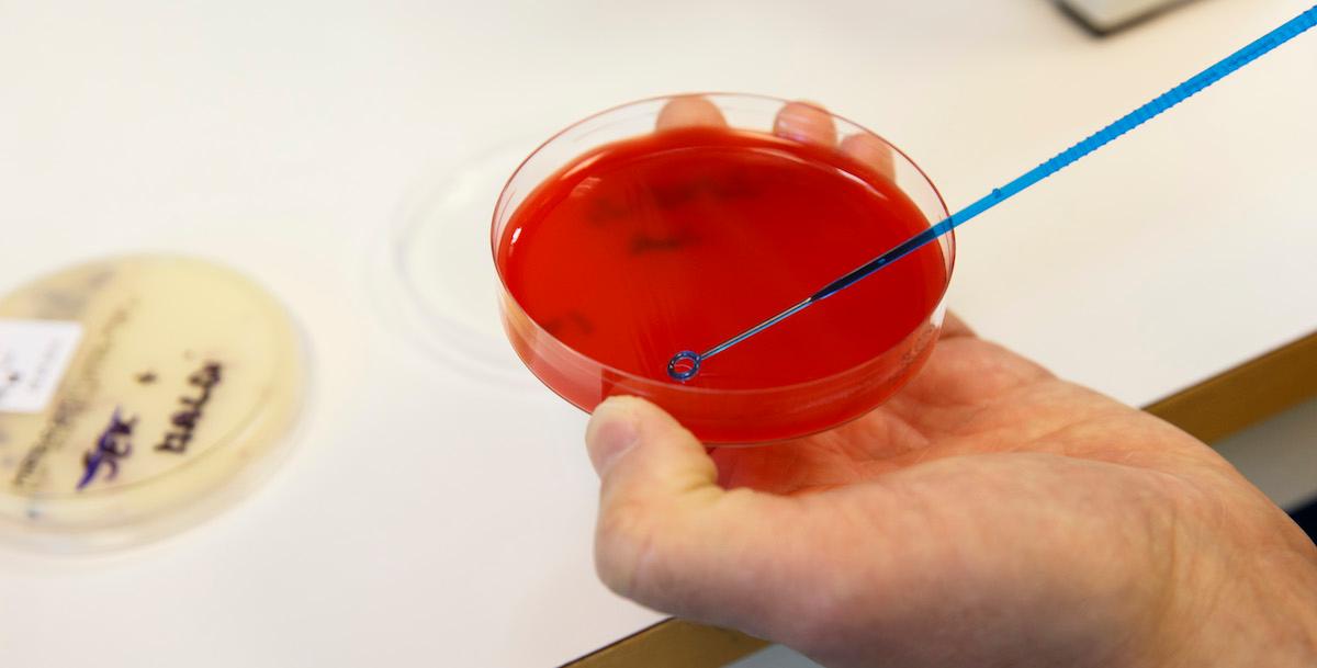 WHO har listat antibiotikaresistens som “ett av de ledande globala hälsohoten”