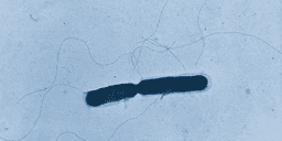 Den sällsynta bakterien har blivit Europas farligaste matgäst