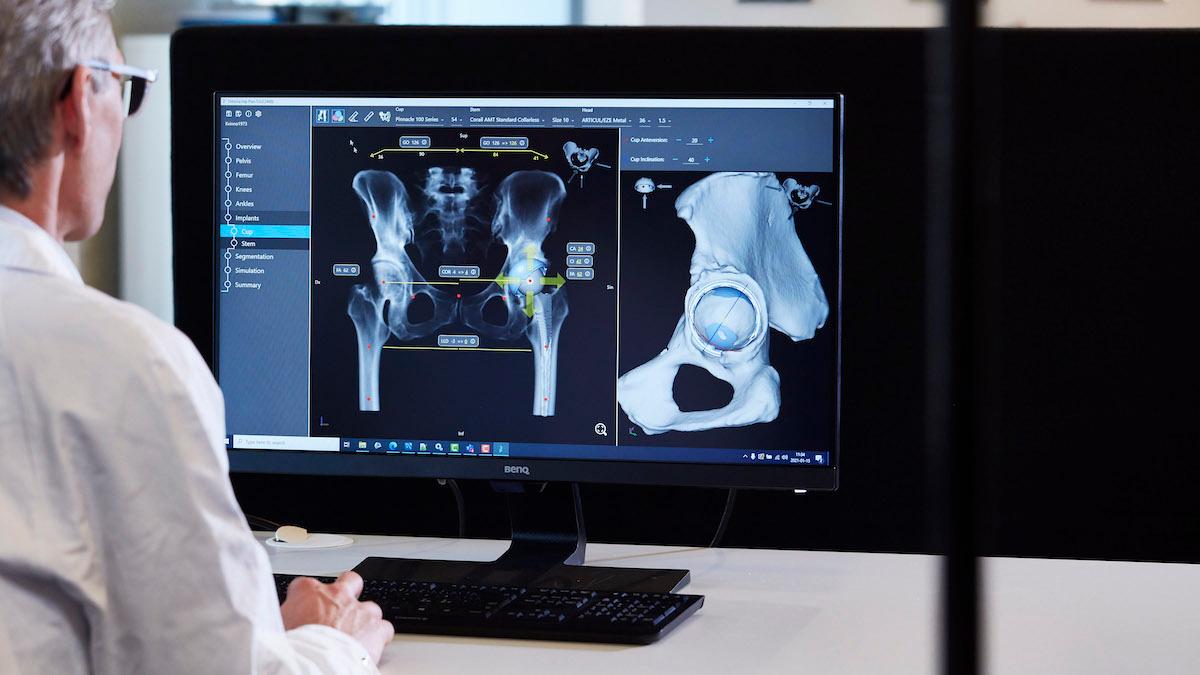 Medicinteknikbolaget Ortoma utvecklar AI-baserade lösningar för ortopediska operationer. Bolaget samarbetar nu inom mjukvaruutveckling och teknisk information med teknikbolaget Semcon