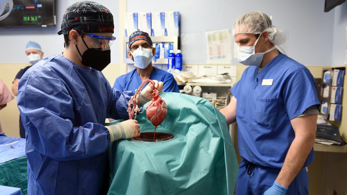 Med hjälp av teknik från svenska Xvivo har nu den första lyckade transplantationen av ett grishjärta till människa genomförts i USA