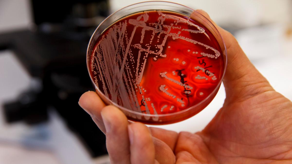 Antibiotikaresistenta bakterier. Forskare har hittat en ny mekanism som gör det möjligt för bakterier att bli resistenta mot antibiotika