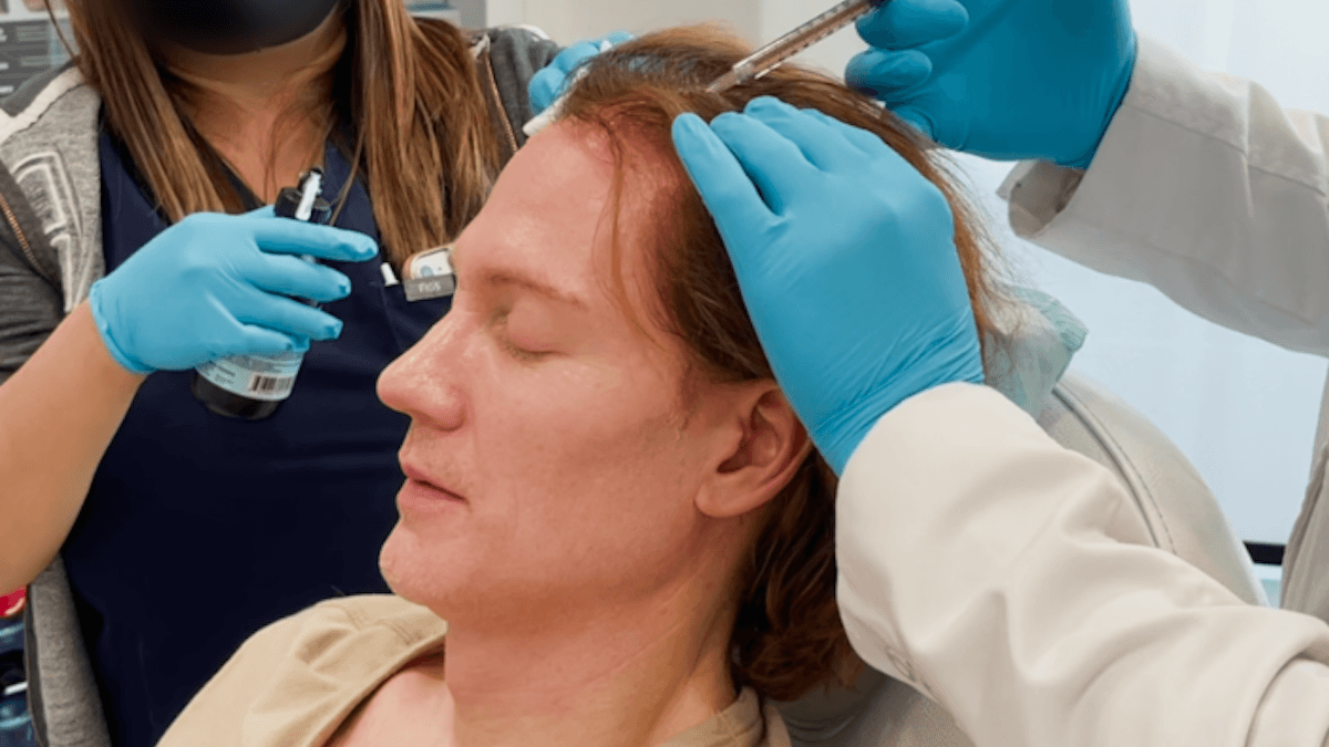 Bryan Johnson uthärdar dussintals medicinska procedurer varje månad i sin jakt på en ung kropp. Här är det håret som behandlas