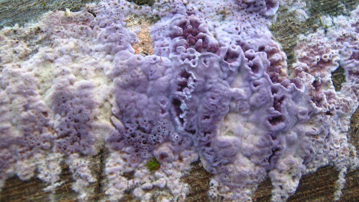 En svamp, Chondrostereum purpureum, eller purpurskinn, som orsakar sjukdomen silverglans hos träd, har infekterat en man i Indien.