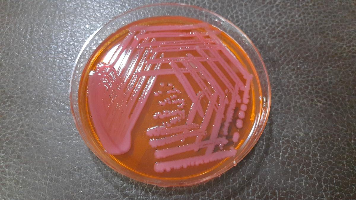 Tillväxt av antibiotikaresistenta Actinetobacter baumanii efter 48 timmar. Nu har forskare med hjälp av AI funnit en ny sorts antibiotika som kontrollerar deras tillväxt.
