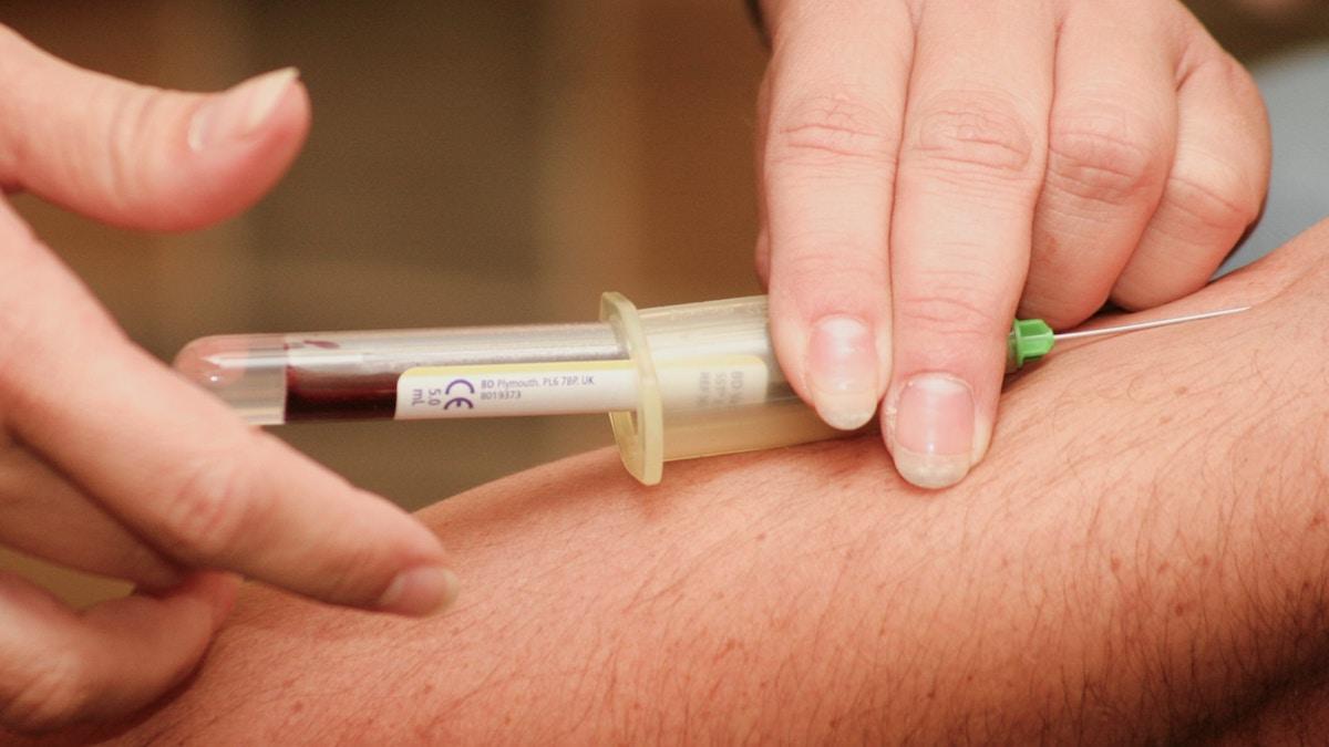 Ett blodprov som kan upptäcka cancer har visat riktigt lovande resultat, det är dock ännu inte tillräckligt korrekt