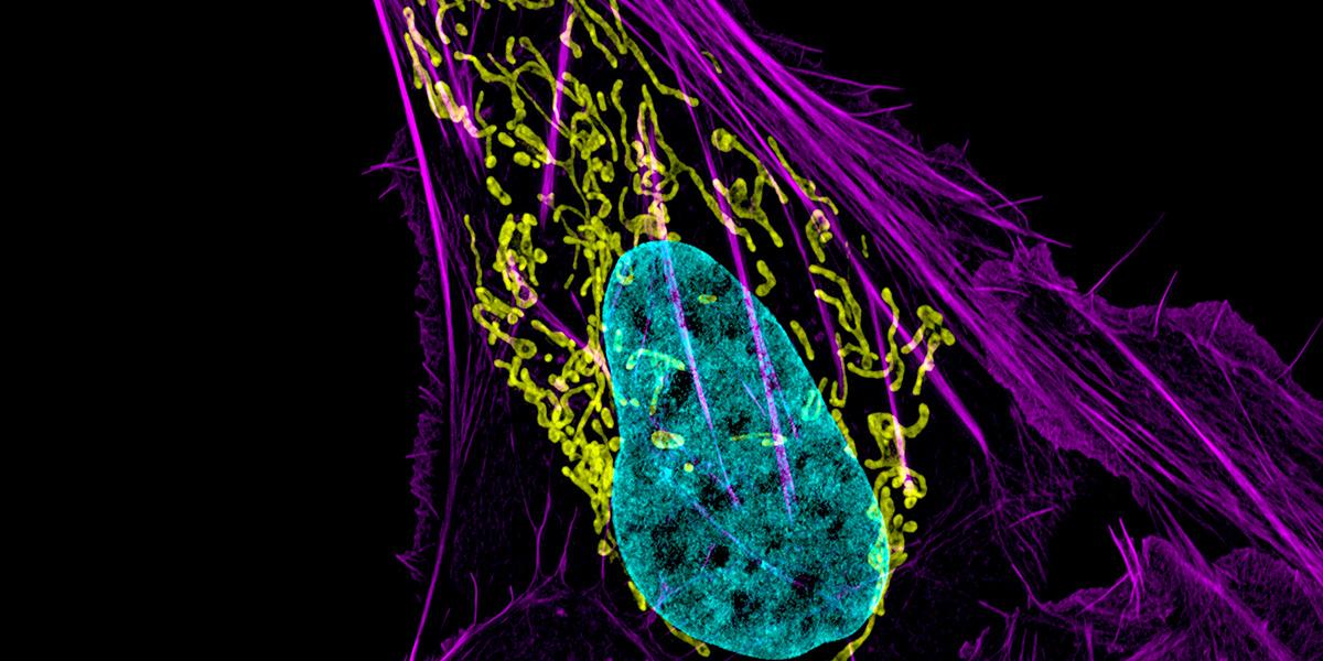 En cancercell med DNA i blått, mitokondrier i gult och en del av cellskelettet i lila. Forskare har nu hittat ett sätt att via mitokondrierna förbättra vårt immunförsvars förmåga att känna igen cancer