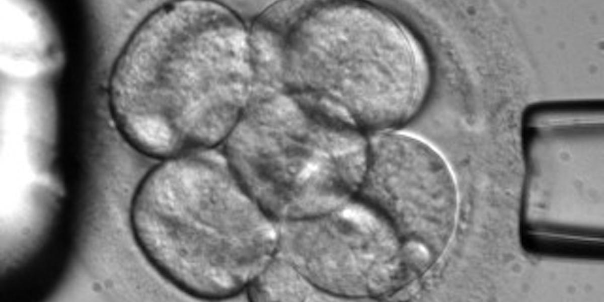 Ett mänskligt embryo. Nu har forskare i Israel gjort ett genombrott i framtagande av en labbodlad embryoliknande modell av ett mänskligt embryo