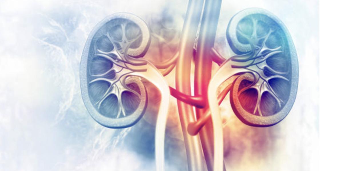 Vital 3D Technologies jobbar med en lösning för att öka hastigheten på 3D-utskrifter av njurar