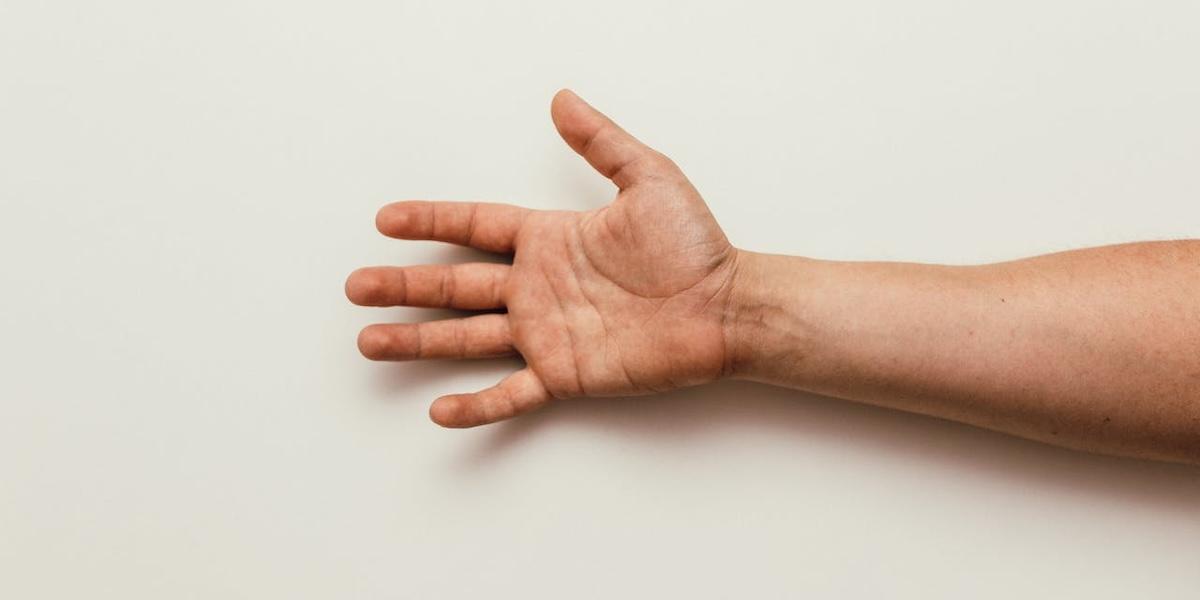 Nerver som styrde en amputerad fot har överförts så att de kan återge rörelseförmågan till en förlamad hand