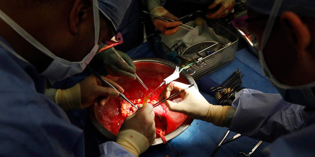 Organtransplantation, förra året slog Spanien sitt eget rekord i antalet genomförda transplantationer