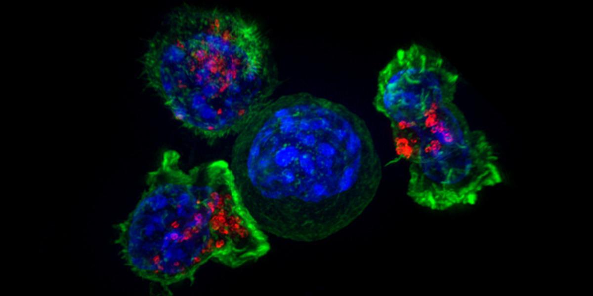 En grupp mördar-T-celler (gröna och röda) omger en cancercell (blå). Forskare har funnit hur cancer skyddar sig mot T-celler