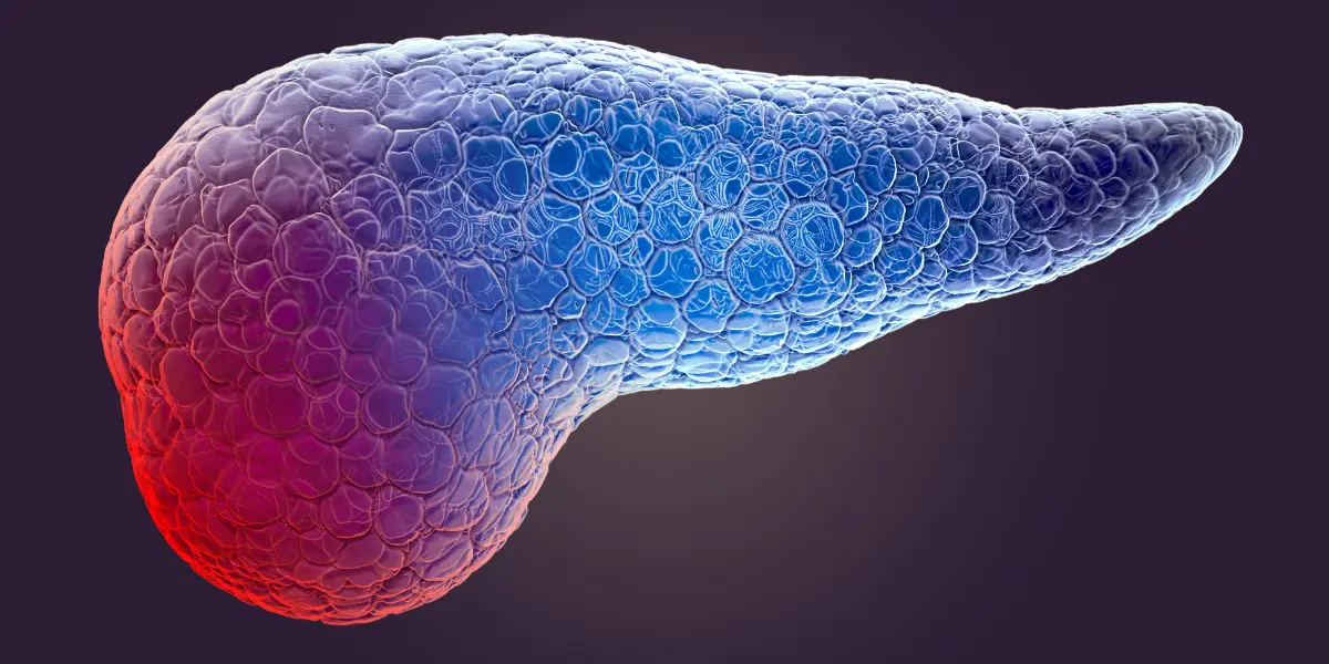 Bukspottkörtelcancer är en allvarlig sjukdom som börjar i bukspottkörteln och kan spridas snabbt. Varje år drabbas cirka 1 500 personer i Sverige av cancer i bukspottkörteln. Tidiga symtom är ovanliga, men kan vara buksmärta, viktnedgång, gulsot och trötthet. Sjukdomen upptäcks ofta sent.