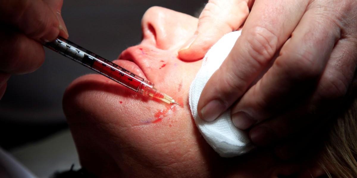 Kritisk granskning av företag inom plastikkirurgi